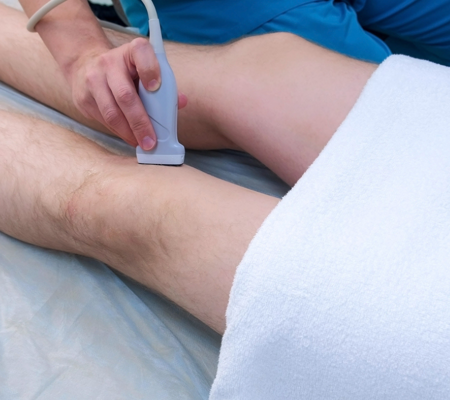 Sonoma Vein Cardiovascular Laser Group, UGS – Ultrasound Guided Sclerotherapy